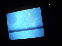 ヒトデ２